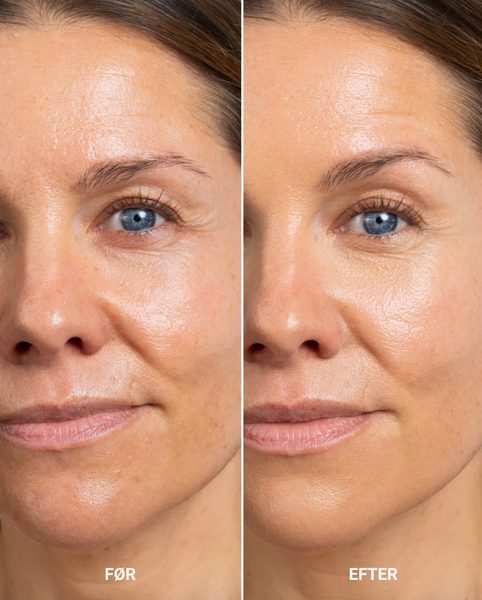 Perfecting Concealer - Light/Medium Neutral Golden