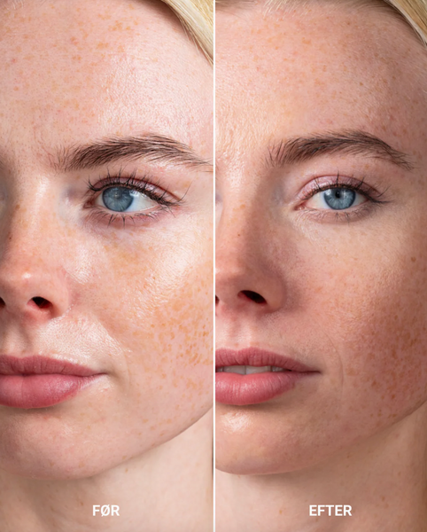 Perfecting Concealer - Light Neutral Cool Rosy